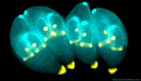 Toxoplasma gondii Toxoplasma gondii