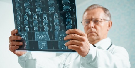 Магнитно-резонансная томография (МРТ) в диагностике опухоли мозга