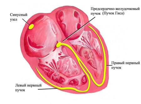 Схематическое изображение сердца:  синусный узел, пучок Гиса, левый и правый нервные пучки