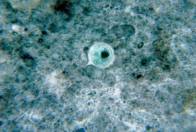 Entamoeba-histolytica-cys Entamoeba histolytica cyst.
