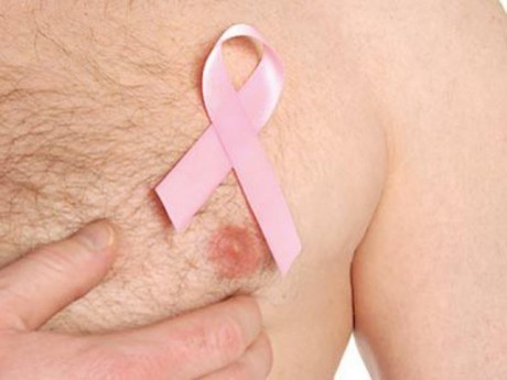Опухоли грудной железы у мужчин лечение thumbnail