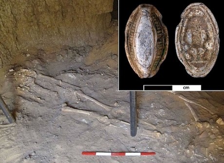 Обнаружен древний скелет человека со следами раковой опухоли