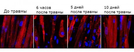 Восстановление искусственной мышцы после повреждения