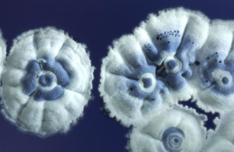 Streptomyces coelicolor - почвенная грамположительная бактерия, принадлежащая к роду Streptomyces